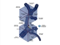 View Sunnyside slide